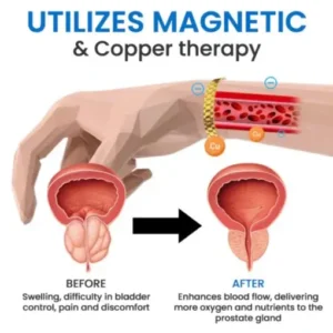 Ceoerty™ CopperMag Prostate Therapy Ring