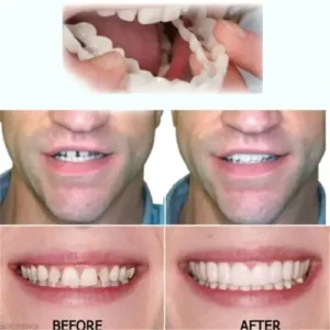 Fivfivgo™ Adjustable Adhesive Dentures