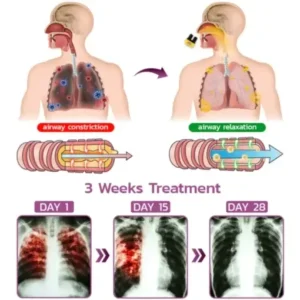 Furzero™ Herbal Lung Cleanse Inhaler