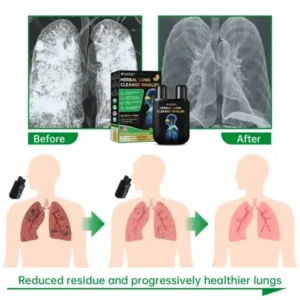 Furzero™ Lung Mucus Cleansing Inhaler