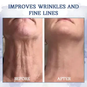 flysmus™ SkinLift Anti-Wrinkle Cream