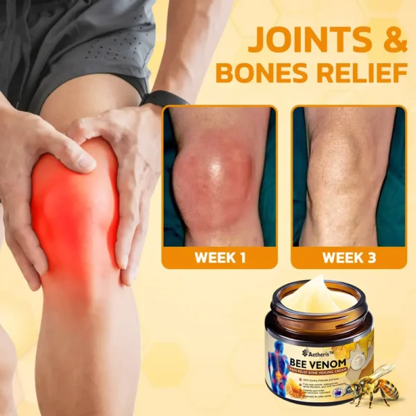 Aetheris™ Bee Venom Instant Ultra Strength Pain Relief Therapy Cream