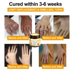 Bearnica™ Bee Venom & Turmeric Arthritis Therapy Cream