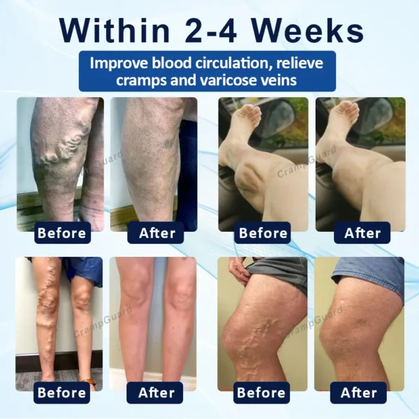 CrampGuard™ Leg Muscle and VeinRelief Cream