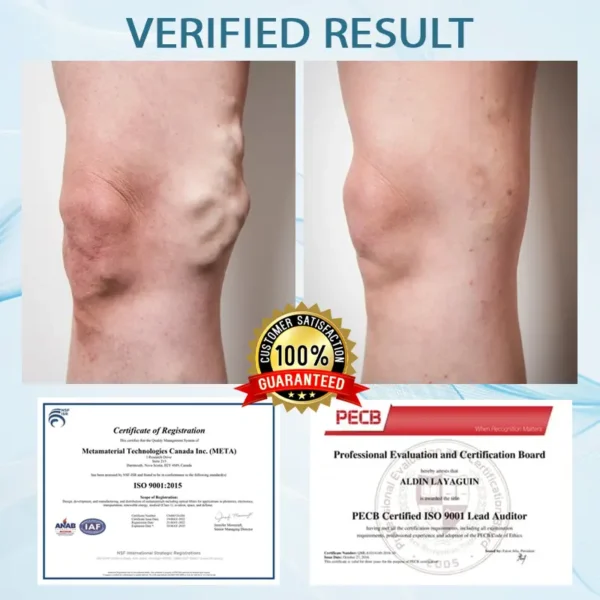 CrampGuard™ Leg Muscle and VeinRelief Cream