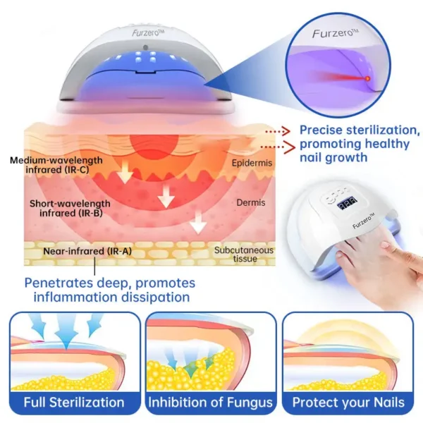 Furzero™ PureNail Fungus Laser Device