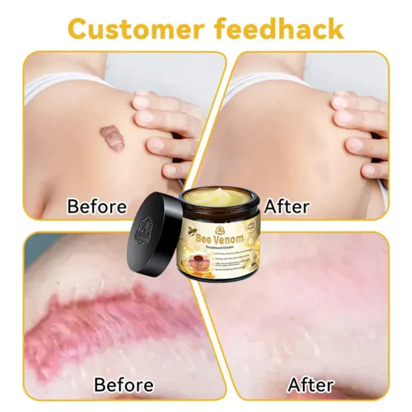 LOVILDS™ Bee Venom Skin Treatment Cream