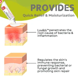 LOVILDS™ GlansCare Anti-Inflammation Cream