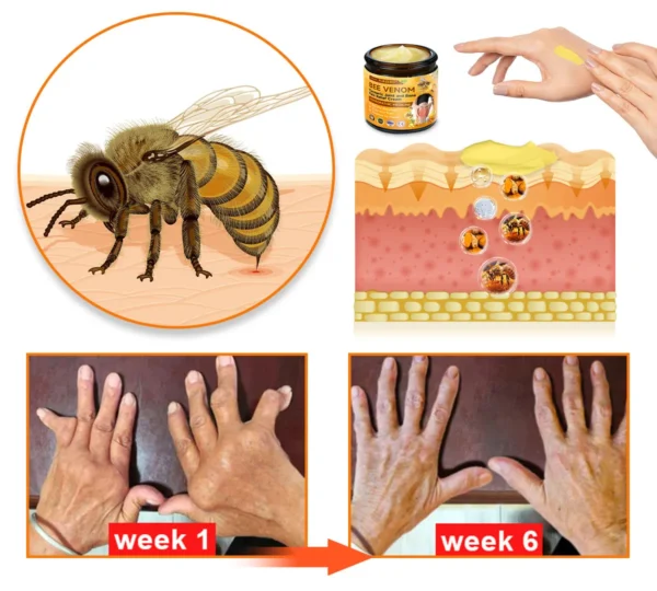 Raindew™ Bee Venom & Turmeric Joint and Bone Pain Relief Cream