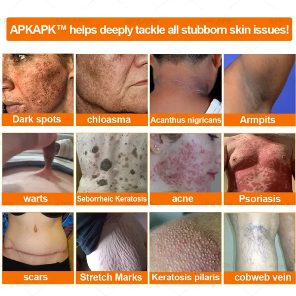 APKAPP™ Effective All-in-One Skin Treatment Cream