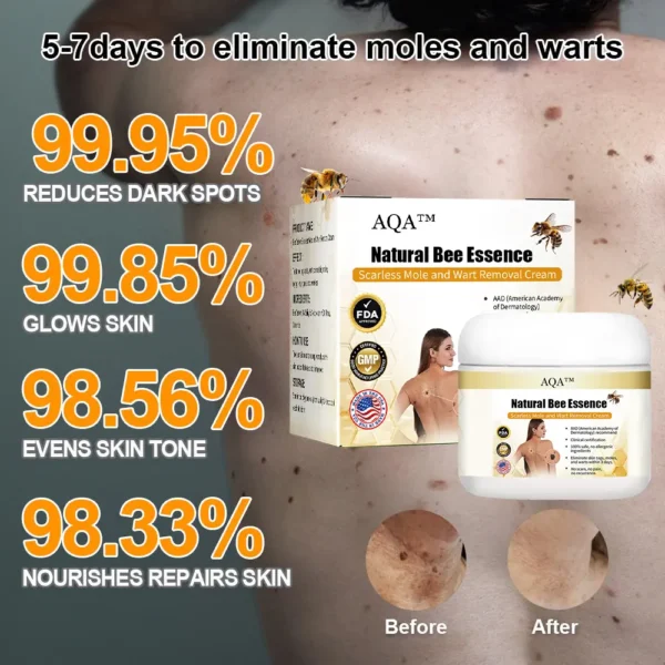 AQA™ Natural Bee Essence Mole and Wart Treatment Cream