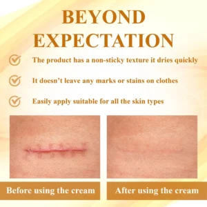 ApisDerm™ VenomClear Skin Treatment Balm