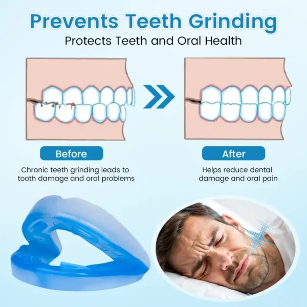 Ceoerty™ Anti-Snoring & Anti-Grinding Teeth Protector