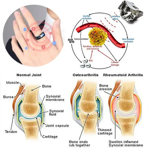 DIYSTAR Lymphatic magnetic therapy ring