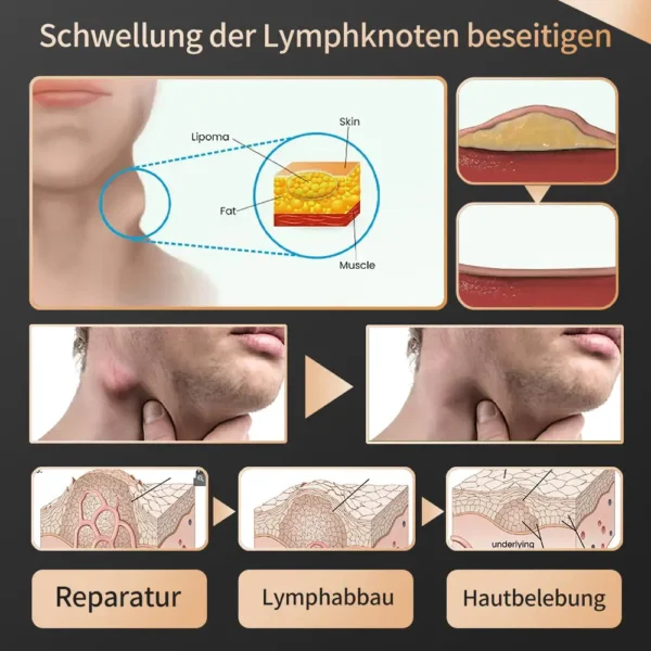 DOCTIA™ Tragbarer Multifunktionaler Naseninhalator-Stick Pro