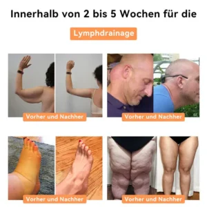 FROPUN™ Bienengift Lymphdrainage Schlankheitspflaster