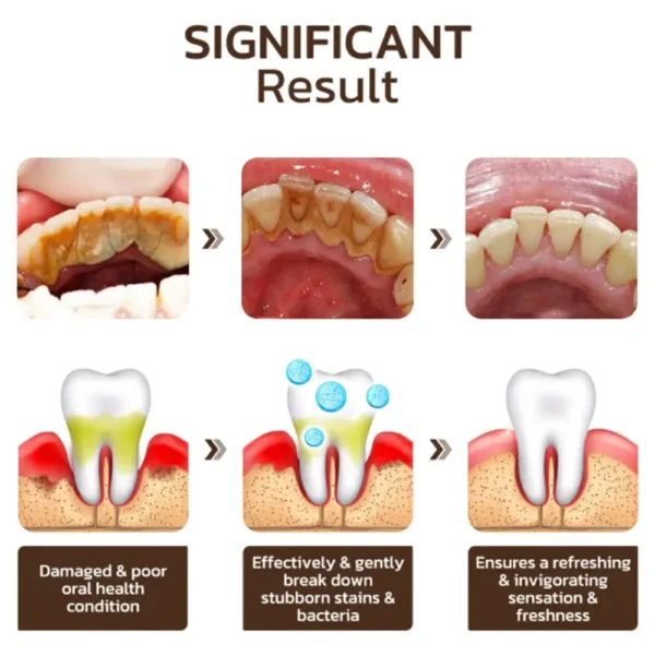 Fivfivgo™ Niacinamide Whitening Toothpaste