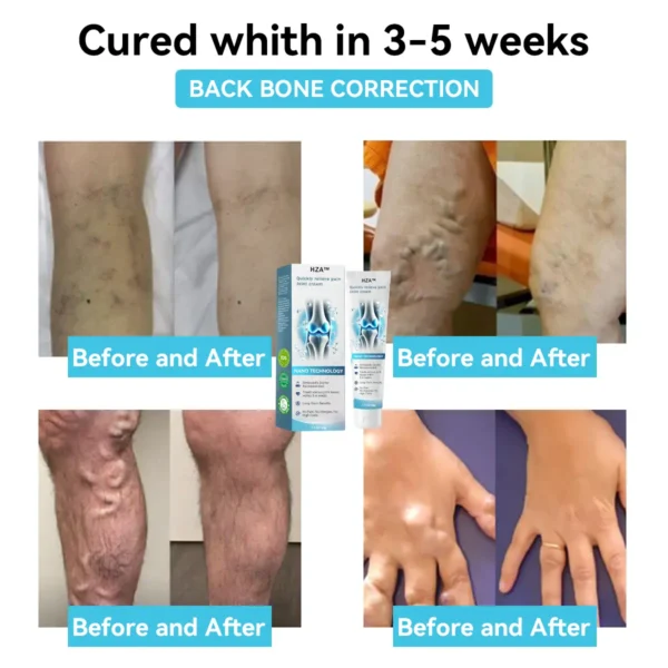 HZA™ Joint Repair Cream