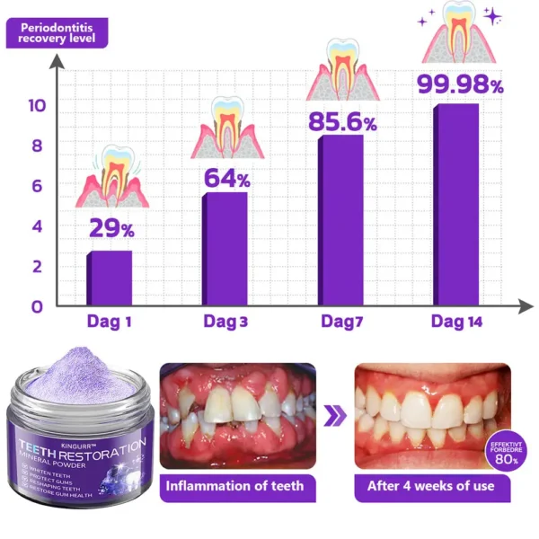 KINGURR™ TeethRestoration Mineral Powder