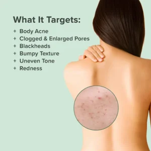 LIMETOW™ Back Acne Treatment Spray