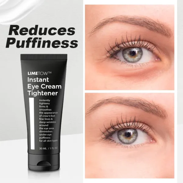 LIMETOW™ Instant Eye Cream Tightener