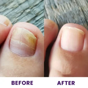 LIMETOW™ Multi-Purpose Nail Repair