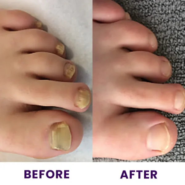 LIMETOW™ Multi-Purpose Nail Repair