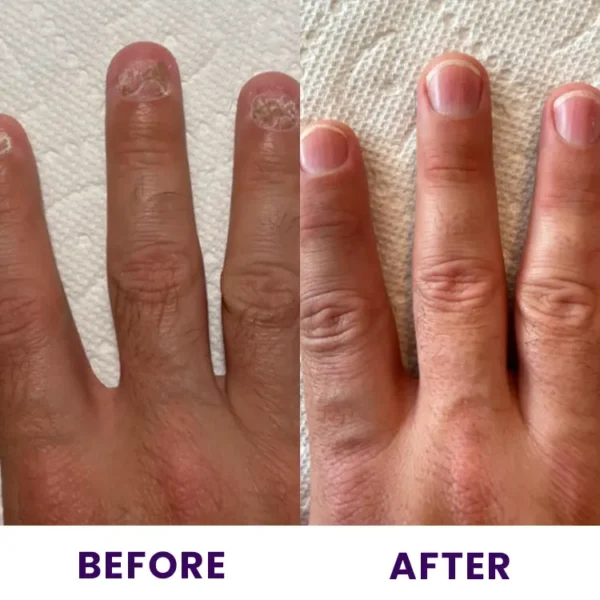 LIMETOW™ Multi-Purpose Nail Repair