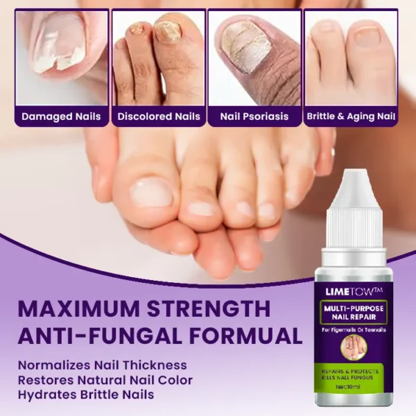 LIMETOW™ Multi-Purpose Nail Repair