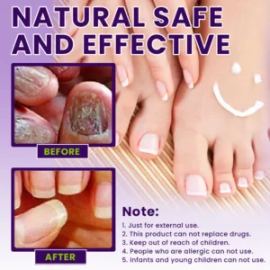 LIMETOW™ Multi-Purpose Nail Repair