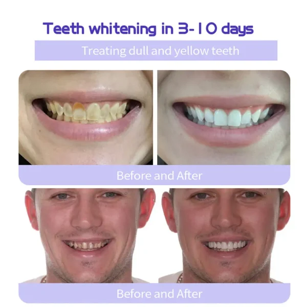 Lovilds® Teeth Restoration Mineral Powder