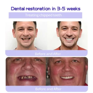 Lovilds® Teeth Restoration Mineral Powder