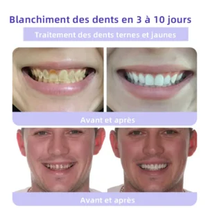 Oyikey™ Teeth Restoration Poudre Minérale