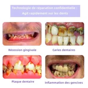 Oyikey™ Teeth Restoration Poudre Minérale