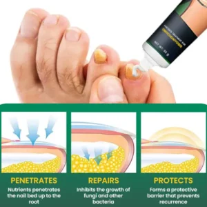 PANNIMA™ Nail Care Anti Fungal Cream