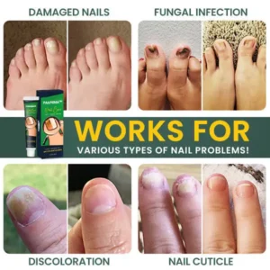 PANNIMA™ Nail Care Anti Fungal Cream