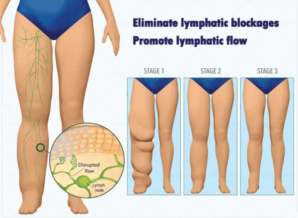 SIENOVA™ Portable Lymphatic Detox And Joint Relaxation Therapy Device