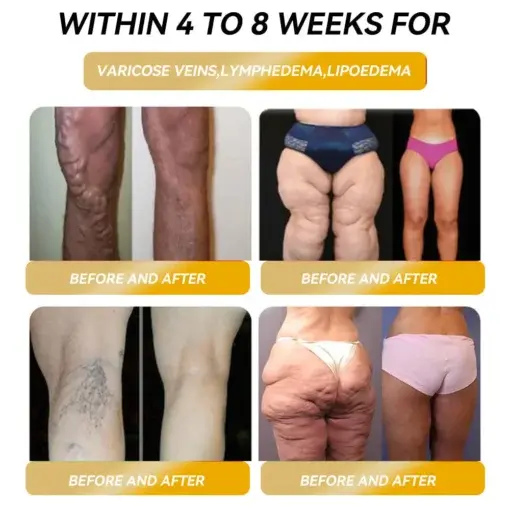 ๐๐๐๐๐๐๐ยฎ ๐๐๐ ๐ง๐๐ญ๐ข๐ ๐๐ง๐๐ซ๐ ๐ฒ ๐๐-๐๐ญ๐จ๐ง๐ ๐๐๐ฉ๐ฅ๐ ๐๐๐ซ๐ซ๐ข๐ง๐ ๐ฌ