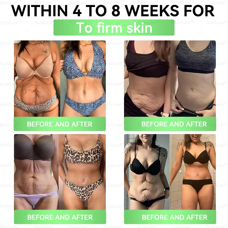 ๐ช๐ฝ๐บ ๐ถ๐๐๐๐๐ ๐ผ.๐บ. | ๐ฉ๐๐๐๐
๐ณ๐๐๐ยฎ ๐๐๐ฃ-๐ญ ๐-๐ถ๐ป-๐ญ ๐ฆ๐น๐ถ๐บ & ๐ฏ๐๐๐๐๐๐ฒ ๐ถ๐๐๐ ๐บ๐๐๐๐๐๐๐(๐๐๐๐ ๐ ๐๐๐ฆ, ๐ฃ๐๐ ๐๐๐๐ ๐๐๐ ๐ข๐๐ก๐ ๐๐ 7 ๐๐๐ฆ๐ ) โ
๐ฆ๐๐ฝ๐ฝ๐ผ๐ฟ๐๐ ๐ผ๐ฏ๐ฒ๐๐ถ๐๐, ๐ฐ๐ฎ๐ฟ๐ฑ๐ถ๐ผ๐๐ฎ๐๐ฐ๐๐น๐ฎ๐ฟ ๐ต๐ฒ๐ฎ๐น๐๐ต, ๐ฑ๐ถ๐ฎ๐ฏ๐ฒ๐๐ฒ๐, ๐๐น๐ฒ๐ฒ๐ฝ ๐ฎ๐ฝ๐ป๐ฒ๐ฎ, ๐ด๐๐ ๐ต๐ฒ๐ฎ๐น๐๐ต, ๐ท๐ผ๐ถ๐ป๐ ๐ถ๐๐๐๐ฒ๐, ๐ฐ๐ก๐ข๐ฅ๐ ๐๐ฅ๐ฌ๐จ ๐๐ข๐ซ๐ฆ๐ข๐ง๐ ๐ญ๐ก๐ ๐ฌ๐ค๐ข๐ง ๐๐ง๐ ๐๐จ๐จ๐ฌ๐ญ๐ข๐ง๐ ๐๐ง๐๐ซ๐ ๐ฒ