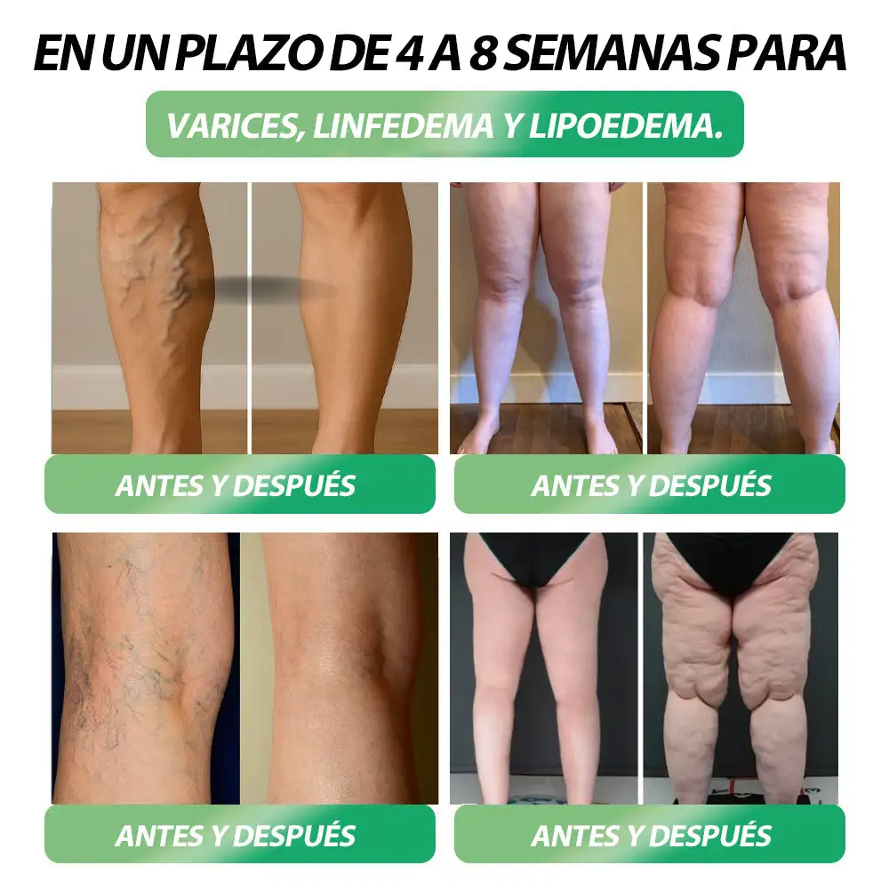 𝐁𝐮𝐢𝐥𝐝𝐋𝐞𝐚𝐟® 𝑮𝑳𝑷-1 𝐅𝐢𝐭 & 𝐕𝐢𝐭𝐚𝐥 8 en 1 𝐒𝐨𝐥𝐮𝐜𝐢ó𝐧 𝐎𝐫𝐚𝐥🥇 (Solo una vez al día, cambios visibles en 7 días) Para obesidad, salud cardiovascular, diabetes, apnea del sueño, salud intestinal, problemas articulares y más(副本)