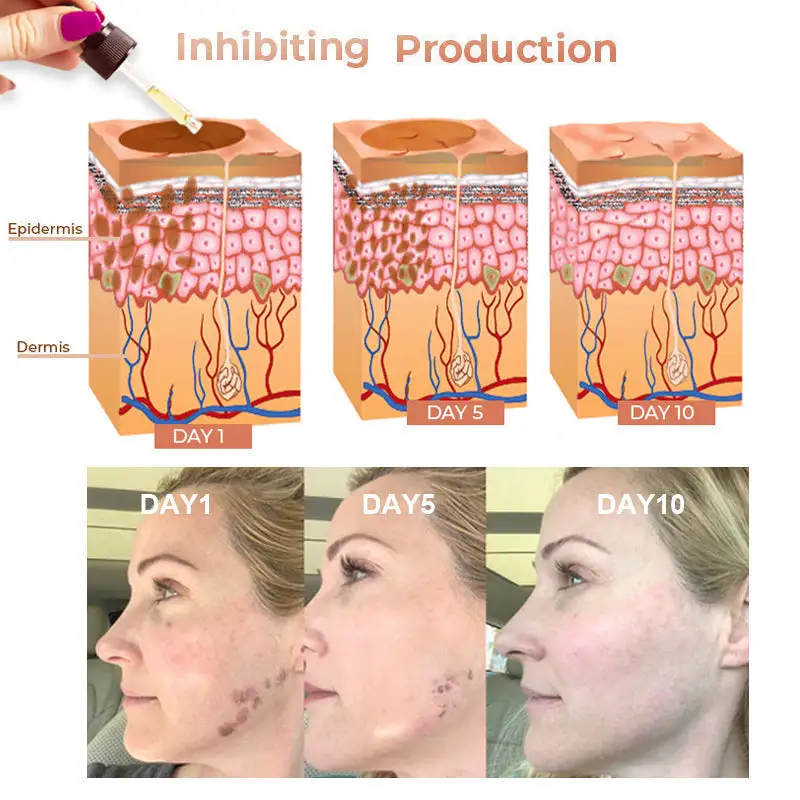 2025s,NESLEMY™ Fast Dark Spot Remover ✨ Where science meets luxury. Our melanin-correcting serum erase