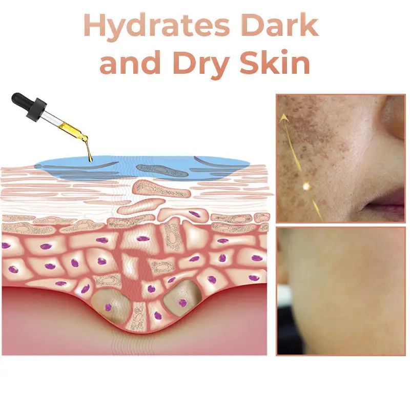 2025s,NESLEMY™ Fast Dark Spot Remover ✨ Where science meets luxury. Our melanin-correcting serum erase