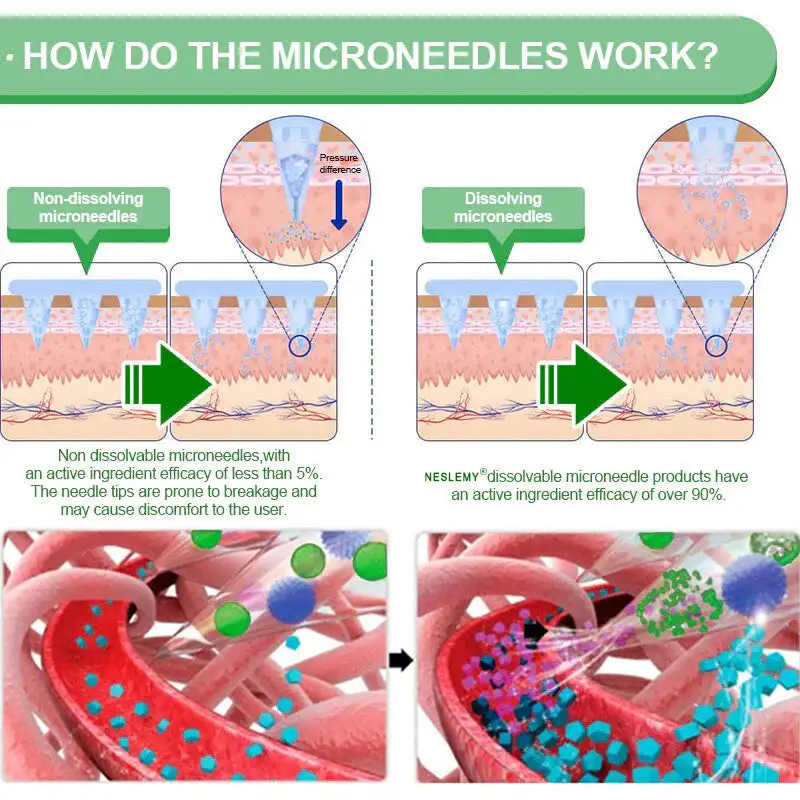 【Last Day Promotion 60% OFF】💕NESLEMY®Tirzepatide Slimming & health NANO MICRONEEDLE PATCH👑(Zero Pain, 24/7 Release | Lose 9 kg FAST | 90% Sugar Drop | )💕