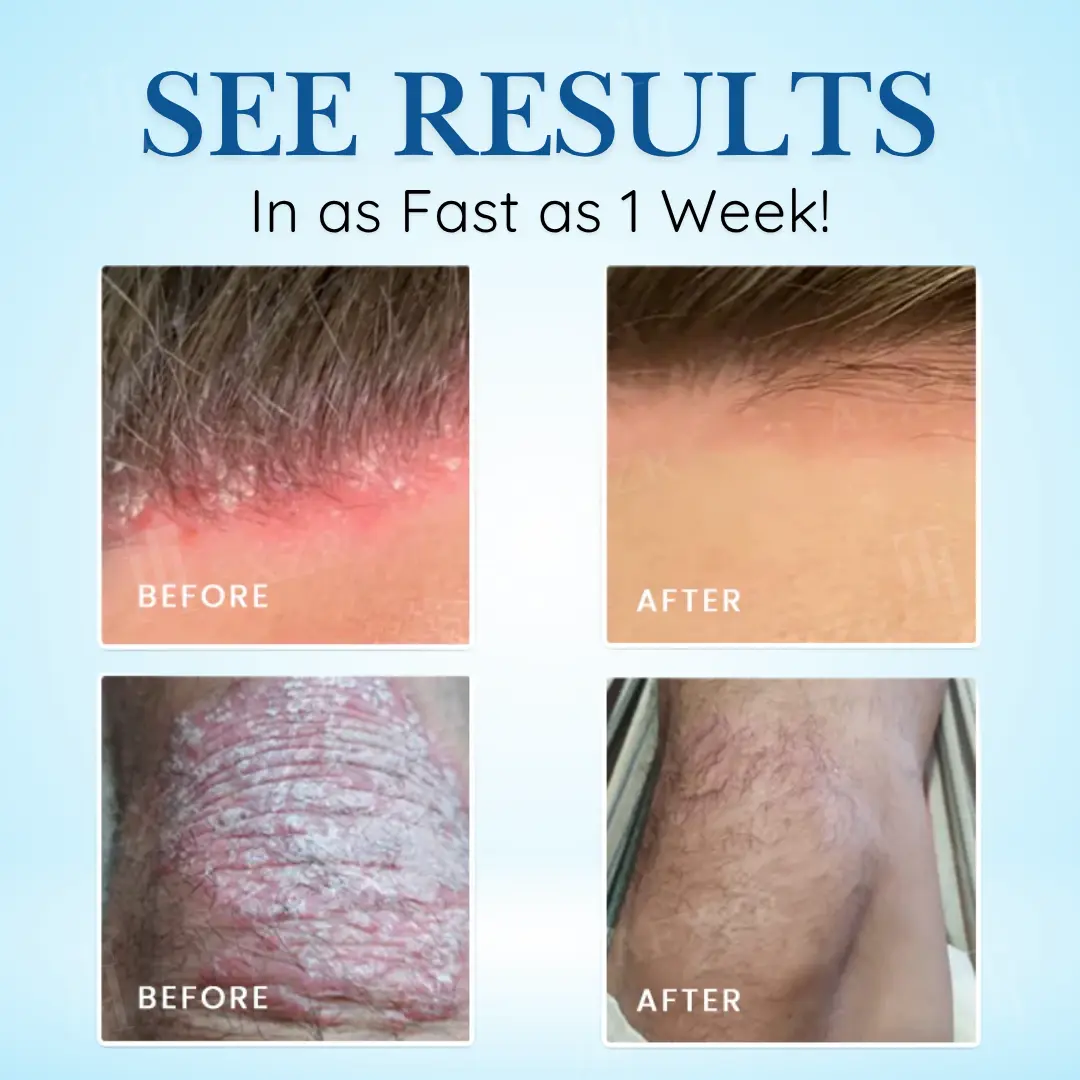 🏷️ EXCLUSIVE DEAL! 64% OFF - Cvreoz® Source-Relief Magnesium Spray