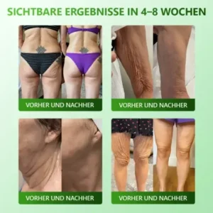 Cvreoz® 𝗬𝗼𝘂𝐭𝐡𝐆𝗹𝗼𝘄 𝑺𝒕𝙖𝙢𝙢𝙯𝙚𝒍𝒍𝒆𝒏 𝙆𝙤𝒍𝒍𝒂𝙜𝙚𝒏 𝗧𝗿𝗼𝒑𝐟𝙚𝙣