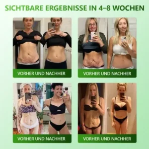 Cvreoz® 𝗬𝗼𝘂𝐭𝐡𝐆𝗹𝗼𝘄 𝑺𝒕𝙖𝙢𝙢𝙯𝙚𝒍𝒍𝒆𝒏 𝙆𝙤𝒍𝒍𝒂𝙜𝙚𝒏 𝗧𝗿𝗼𝒑𝐟𝙚𝙣