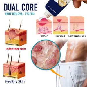 Cvreoz® Genital Warts Remover Cream 👨Designed for Men