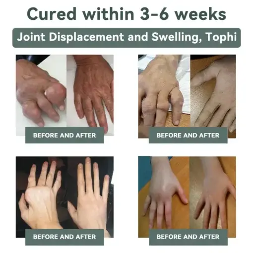 Cvreoz® Nerve Repair &Pain Relief Magnesium Cream