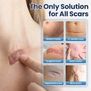 NESLEMY® DermaFix Texture Repair Gel